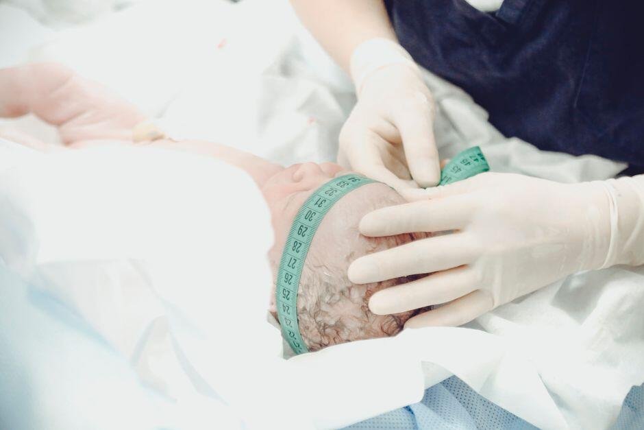 Cradle Cap pada Bayi: Penyebab dan Cara Mengatasinya dengan Aman Pexels Photo 3376800