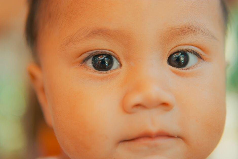 Bintik Kecil di Wajah Bayi tapi Bukan Milia? Ini Kemungkinannya Bintik Kecil di Wajah Bayi tapi Bukan Milia? Ini Kemungkinannya