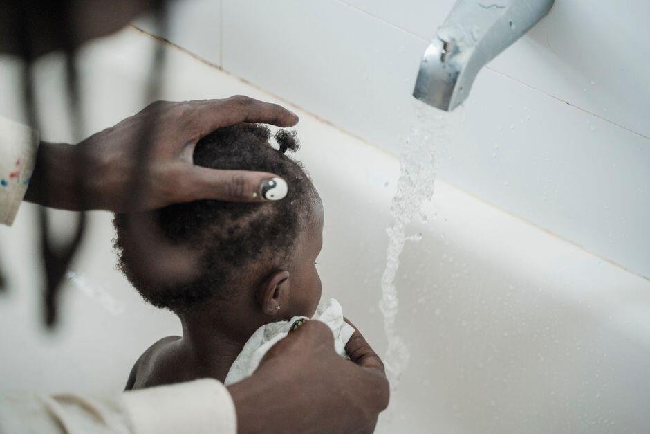 Rambut Pitak pada Bayi, Normal atau Perlu Diwaspadai? Rambut Pitak pada Bayi, Normal atau Perlu Diwaspadai?